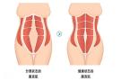 生完娃肚子回不去？不是胖，是“拉链”松了！科学修复看这里